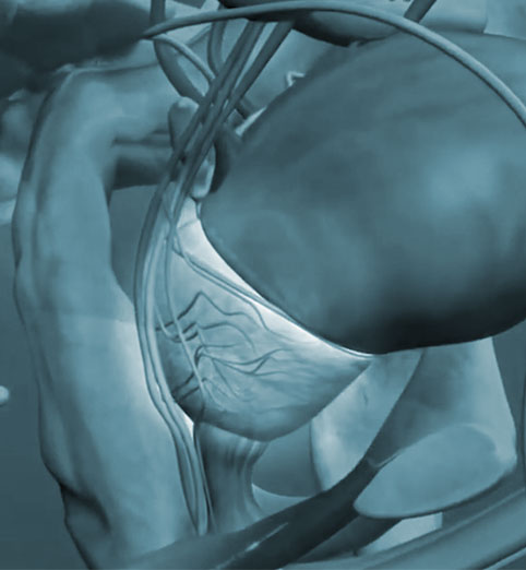 PelviPower™ magnetoterápiás kezelés férfiaknak prostatectomia után PelviPower™ magnetoterápiás kezelés férfiaknak prostatectomia után